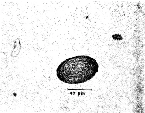 Şekil i. Trichosomoidcs crassicauda yumurtası (The egg of Trichosomoides crassicauda)