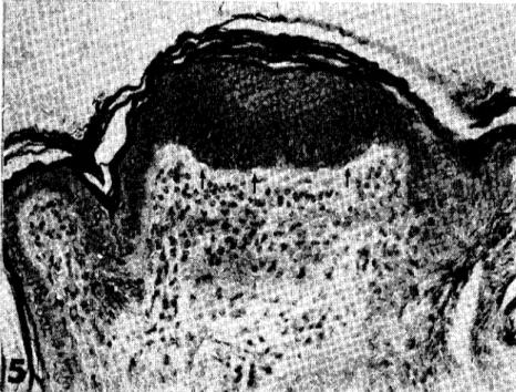 Şekil 5. Bir Haarscheibe bölgesinde, Stratum b'asalc'dc aralıklarla yerleşmiş Merkcl hüc- hüc-releri (aklar); bu bölgede epidermis çok kalınlaşmış durumda