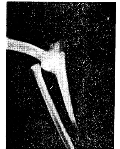 Şekil 1. Olgumuzun operasyon öncesi radyografisi &#34;lateral pozisyon&#34; Pre-opcrative radiography &#34;lateral position&#34;