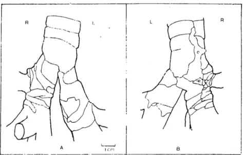 Figure 2. Schenıatic drawing of the bifurcatio tracheac of donkey. Ventral vicw (A), dorsal vicw (B), left (L), i ight (R)