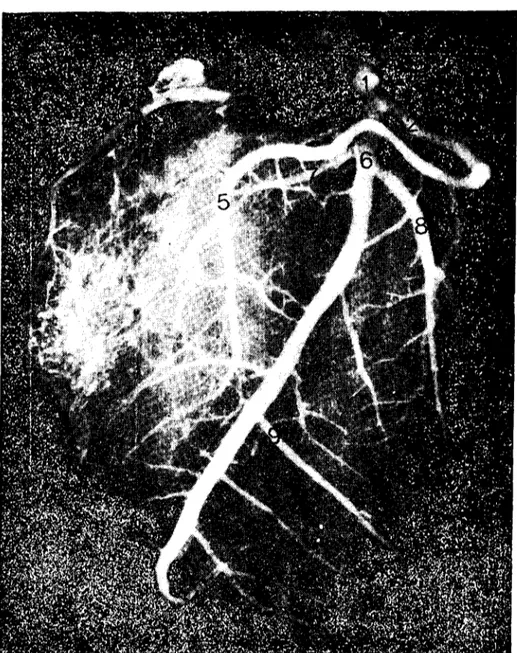 Şekil 4. Doğu Anadolu Kırmızısı sı~ırıncta korolH:r damarların radyografisi. Fig. 4. The radiography of the coronary arteries in Fast Anatolian Red boyine