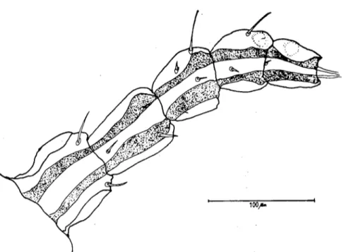 Şekil 6. Linognathidae ailesine bağlı türlerde anten 5 segmentli olması ile karakterizedir (ORiJİ NAL).