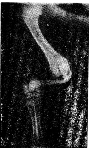 Figure 6. Radiograph of the right antebrachium of male kid; ulna rotated medi~lIy an angI e of 90 degrees, radius was missing