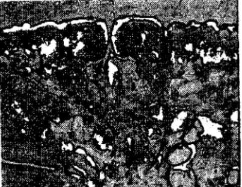 Fig. 7b. Genita! opcning slruclure of ıhe spccimcn iııustratcd in Fig 7a. Note the
