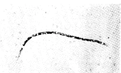 Şekil 3. Dirofilaria repcııs ıııikrofilcri &#34; 400. Microfilaria of Dirofilaria rcpcııs.
