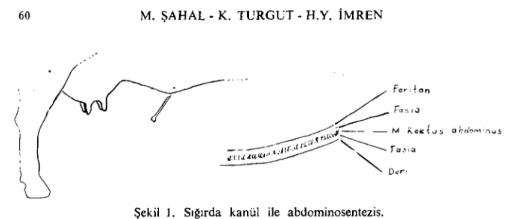 Şekil l. Sığırda kanüı ile abdominosentezis. (Abdominoecntesis in eattle using a eannula.)
