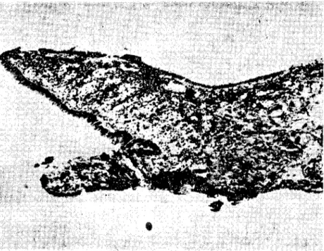 Fig. 8. Hc:ıdfool of uııpara:;itized G./aevis (x 100) (Parazilciz G.lanis'in başayağı)