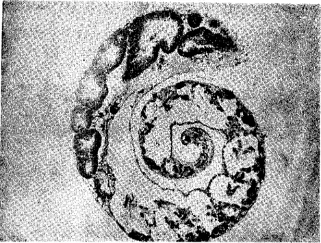 Fig. 2. Digestive gland and ovotestis of unparasitizcd G.laevis (x 40). (Parazitsiz G