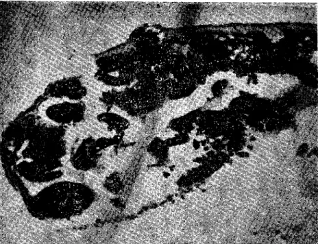 Fig. 4. Moderate parasitized digeslive g!and of G.lael'is (x 100). (G./aevis'in orta derecede parazitli sindirim bezi)