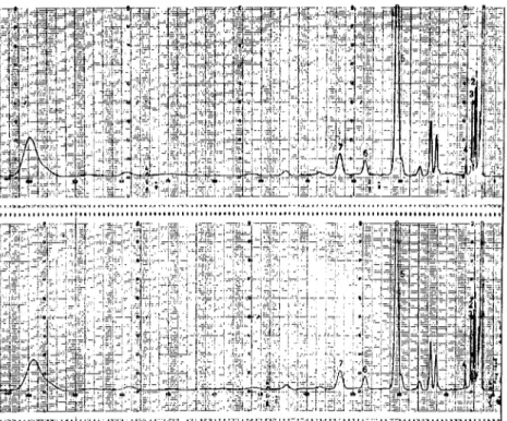 Şekil ı. Işınlanmış (10 kGy) ve Jşııılanmamış karabjb~r örıı:-klerinin uçucu yağlarına ait kromatogram.