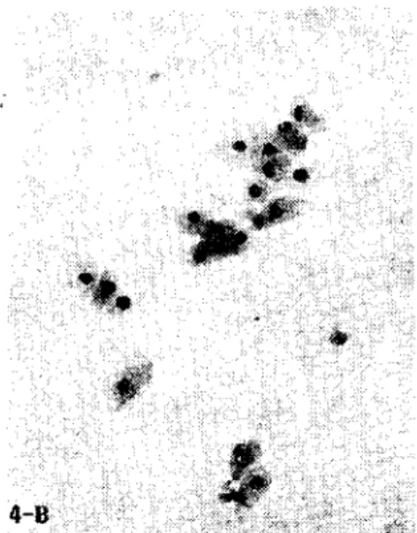 Şekil 4. Anöstrus (4-A, x 100; 4-B, x 150; 4-C, }(. 2(0)
