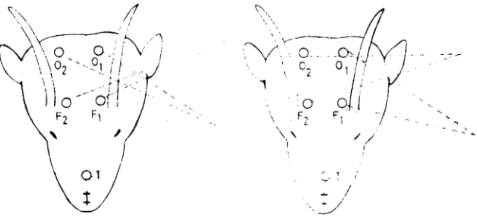 Şekil i a: Transhemisferik (Coronal) b: İntrahemisfcrik (Longidutinal), bipolar yazdırma.