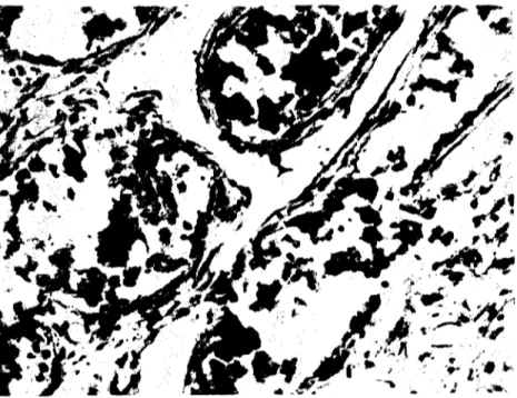 Şekil 4 Tubulus hiic!'ekrinin sitoplazmalarında yağ globulleri: Oil-rcd-O X IGOO