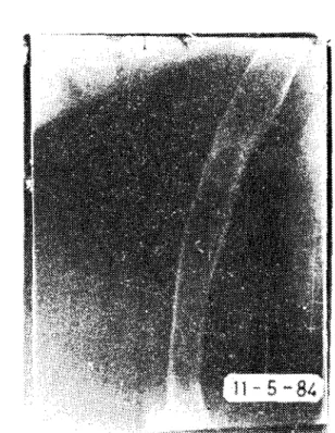 Şekil 5: Ostcoseııtesde altı ay sonraki radyolojik görünüm. Fig. 5: Radiological appearcncc six months af ter osteosynthesis.