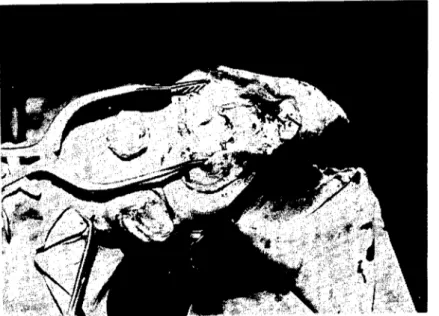 Fig. 6. Appearance of the resected tendon and dissection to the directian distaly.