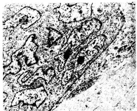 Şekil 5. Çok çekirdekli bir dev hücresi. Fibroblast-benzeri bir hücre ile yakın ilişkide (F)