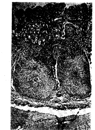 Şekil 4. Ileum. Lenfoid merkezIerde nekroz, yerlerini retikuler makrofaj-tipi hücreler dol-