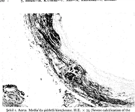 Şekil ı. Aorıa. Media'da şiddetli kireçlenme. H.E. X 75 (Severe calcification of the media of the aorta)