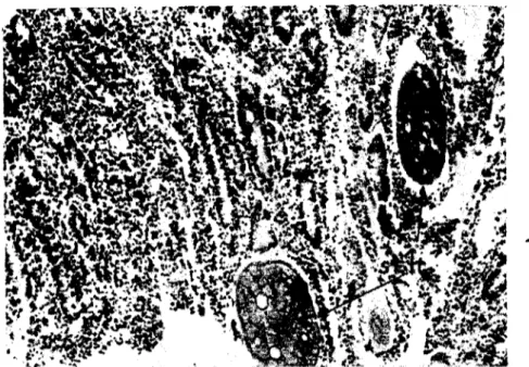 Şekil 2: Enfekte o~lakta inee barsa~ın propria mukozasında görülen lökosit infiltrasyonu (x 210)
