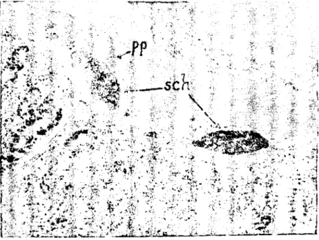 Şekil 3: Lenfatik damarlarda ı. nesil şizontlar (x ı10) (lst generation sehizonts in the lymphatic vessels of smaIl intestine of a kid died from E