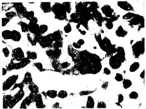 Şekil 7: ınce barsak mukozasında E. arloingi enfeksiyonu sonu artan makrofaj hücreleri (dev hücresi) (x 2200)