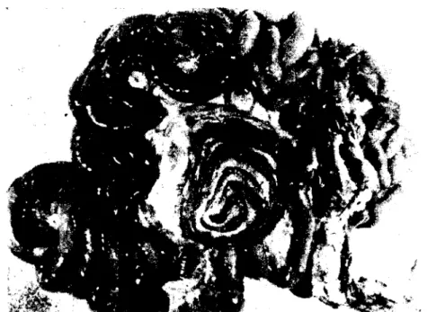Şekil 9: E. arloingi enfeksiyonundan ölen bir oğlağın ince barsağının şişkin ve ödemli hali