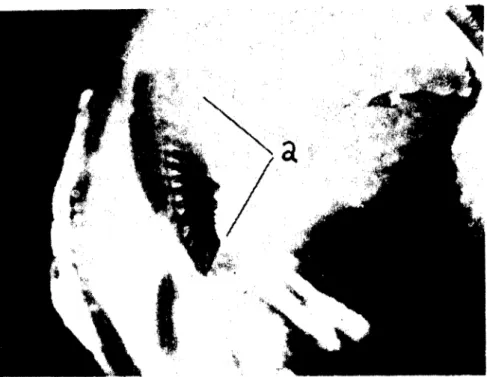 Şekil :.1-a) Tavukta pecten oculi'nin görünümü X7 Fig . .'i-a) Peclen oculi of hen, general view.