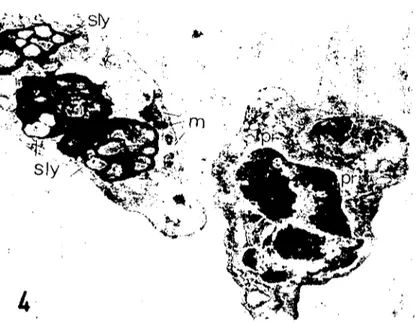Şekil 4. Iki kez ışıltlanmış tavuktali iki trombosiı, pr) perinuklcar aralık (~ok geniş), m) mitokoııdri).a, sly) sekunder Ezazam