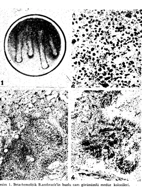 Figure I. Beta haemolyticB. antlıracis.