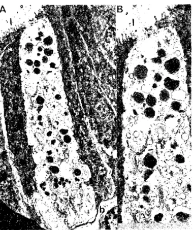 Fig: 3 Pasition of an enteroehromaffin eeıı ALL viııus, extending to the lunıen, b) basement
