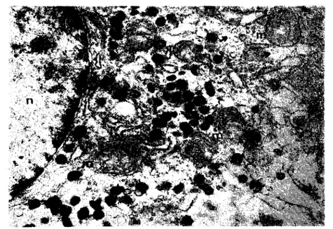 Fig: 8 Another~example of cell type, mentioned in l~ig. 7, n) nucleus, m) ınitochondria, arrows) polisomes