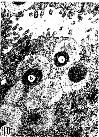 Fig. LO. The apex of a neck ceIl from a fundie gland in a 16-day-old lamb. The mucous granules (a) bear dense-cores (b) which are eccentricaIly located