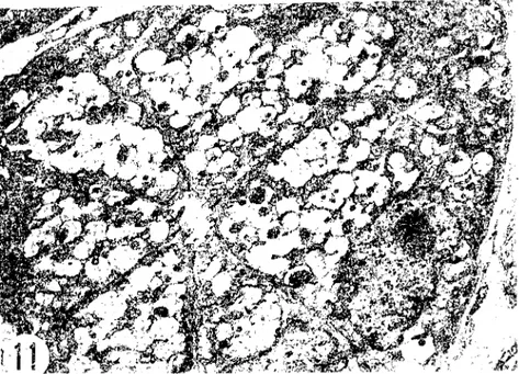 Şekil i ı.2 Günlük buzağıda bir pylonıs bezİnin carpus&#34;u. Hücrelerdeki müköz granüııerde, irili ufaklı dense-core'lar giırii!mekte