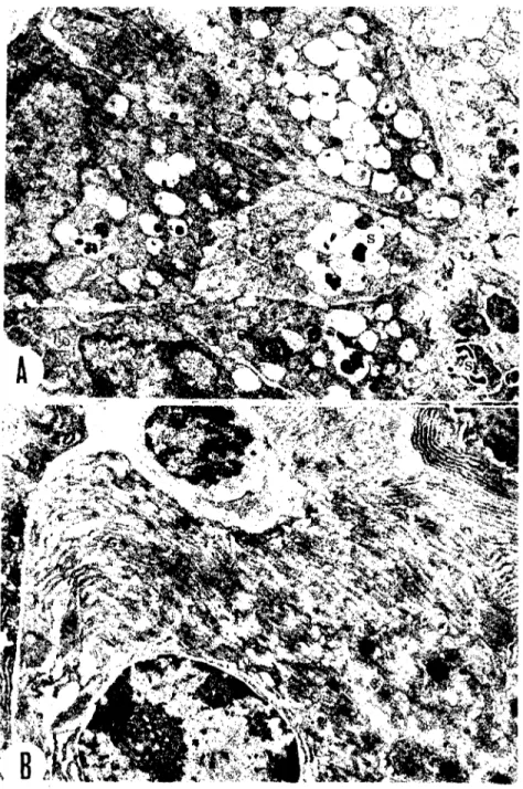 Şekil 2. Bayat glutaraldehyuin etkileri. A. Pylorus bez epitel hücreleri (kuzu). Hayloplaz- Hayloplaz-maua ve salgı graııüllerinde (s) ınyelin figürleri (iç içe yerleşmiş siyah lameller) şekillenmiş