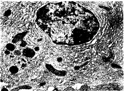 Şekil 6. Aynı tür hücrelerin farklı fonksiyon periyotlarındaki görünümleri. A. !siirahat (i) ve fonksiyon (f) evresinde olan iki pancreas epitel hücresi