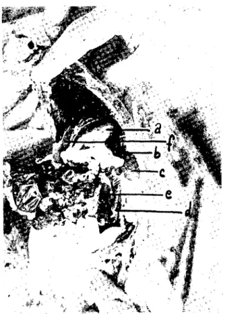 Fig: 2- A- The eross-seetion of the abdominal eaviıy üf ıhe ehinehilla as seen from