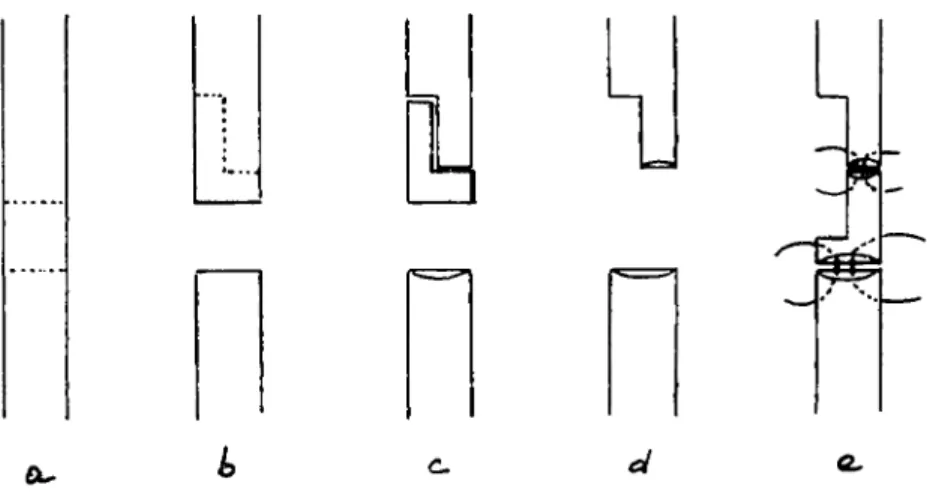 Şekil 2. Vaka 4,5 de kullanılan dikiş şekli Sulures which are used in case 4,5