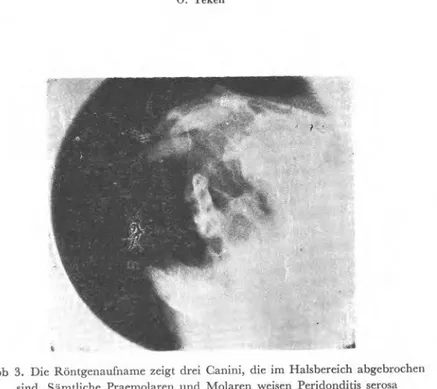 Abb. 4. Röntgenaufnahme einer mit Oligodontie. 