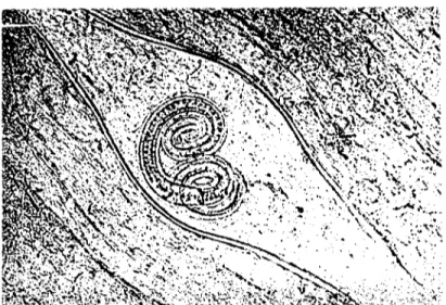 Abb. ı. Larven von Trichinclla spiralis in der Zwerchfellmuskulatur eincs Wildschweins