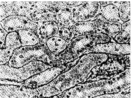 Şekil 4. Böbrek korteksinde lipid granüllerinin yerleşme durumu.Pars convuluta proxi- proxi-malis'ler (a) lipid granüllerinden zengin; Pars convoluta distalis'ler (b) ise granül taşımıyor.