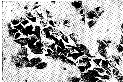 Şekil I. Östrogen tipli froti: I. asidafil piknotik yüzlek hücreler Abb. ı. Oestragentyp: I.azidaphile pyknotische Obcrflaechenzellen.