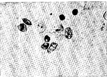 Şekil VII. x Epitel hücrelerinde vakuallcr Abb. VII. x Epithelzellen mit Vakualen.