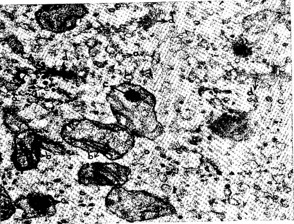 Şekil 7. Yumurtland.ıktan 60 dakika. sonra tespit edilmiş bir zigotun sitoplazması. Mi~o- Mi~o-kondriyal krfstalar (b) genç oositteki şekillerine dönmüş ve mitokondriyal matriskte koyu granüller (c) belirmiş