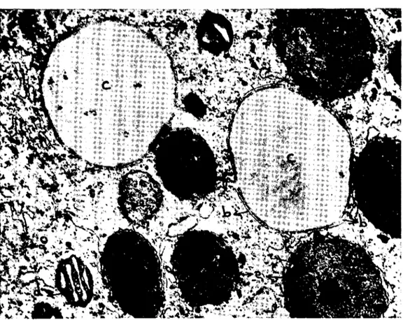 Şekil 8. Yeni yumurtbnmış bir zigot!a yağ d;&gt;.rnlankları (c). a) Ribozamların teşkil ettiği bir Polysomc, b) ye.ğ d&#34;mbcıkl,mm kucc.klayan yassı endoplazmik kesccikler, d)  şiş-kin kristah hir mitokondriyum, e) değişik gelişme basamaklarında bulunan 