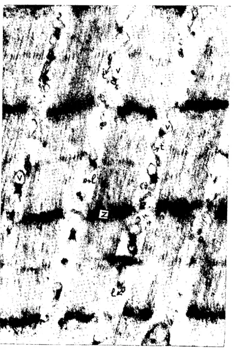 Fig. 6. The state of localisation of the sarcoplasmic reticulum between the myofibrils