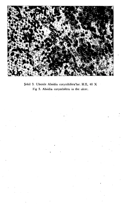 Şekil 3. Ulscrdc Absidia corymbifcra'lar. H.E, 40 X Fig 3. Absidia corymbifera in the ulcer.