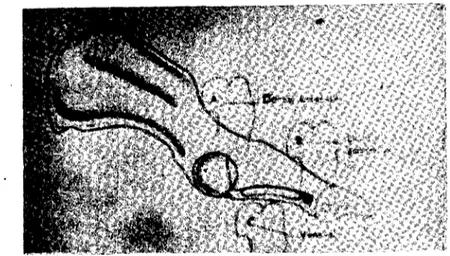 Fig. ı. Resting poston of the head of ıhe femur is seen as a rough draft.