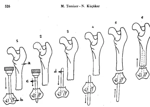 Fig. 2. The replacement method of the bone pin from the distal epiphysis of femur.