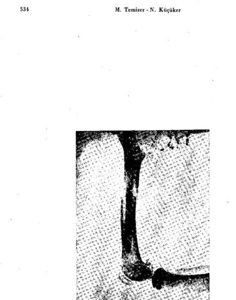 Fig. 14. The situation of the case 14, af ter the fixing whith headless and impermanent bone