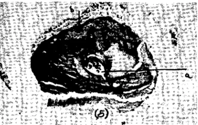 Fig: 5. Cross seetion of the middle part of the COIlllTleııa. X 100. a - meduııary cavity, b - bone ceııs.